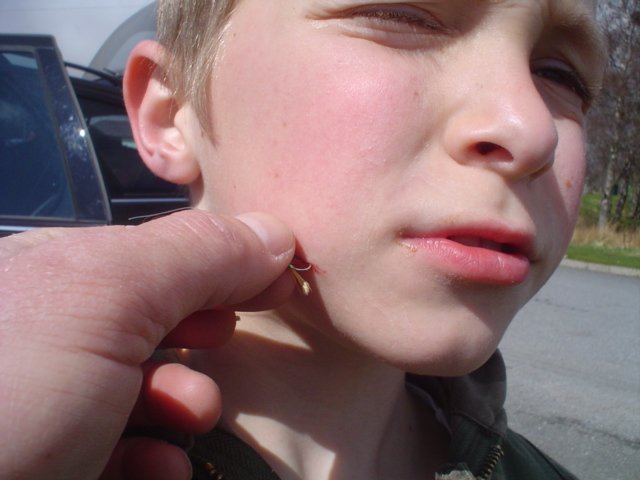 Toby after catching himself with his fly